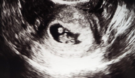 [なな]妊娠記録　妊娠発覚～3か月目始まり