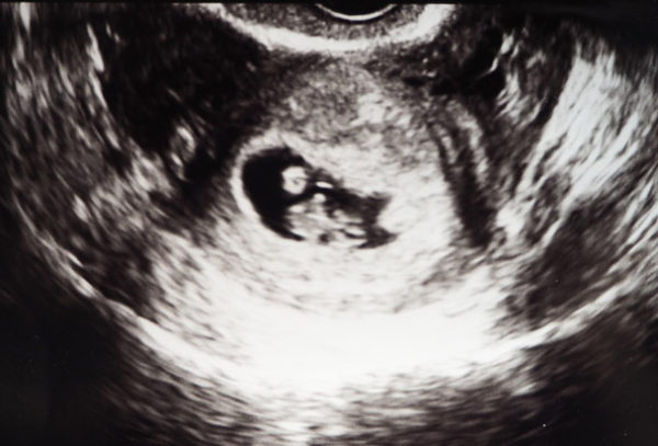 [なな]妊娠記録　妊娠発覚～3か月目始まり