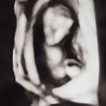 [なな]妊娠記録　3か月目始まり～4か月目に入るまで(胎児ドック)