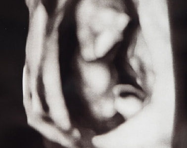 [なな]妊娠記録　3か月目始まり～4か月目に入るまで(胎児ドック)